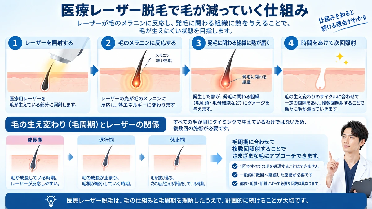 メンズ医療脱毛の部位別回数と仕上がり目標の考え方を示した図