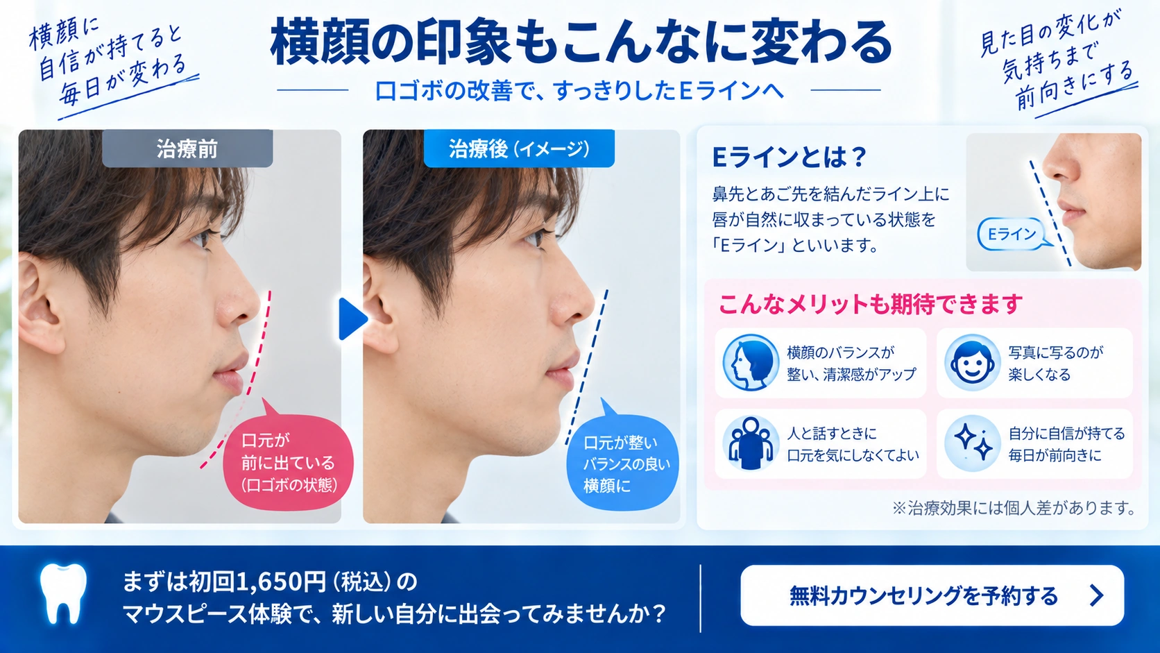 口ゴボや横顔の悩みで確認したいポイントをまとめた図解