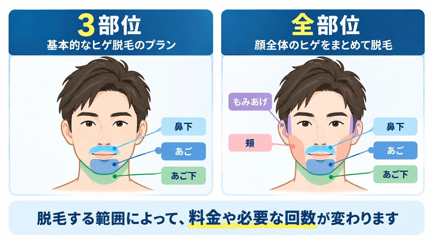 ヒゲ脱毛3部位と全部位の照射範囲の違い