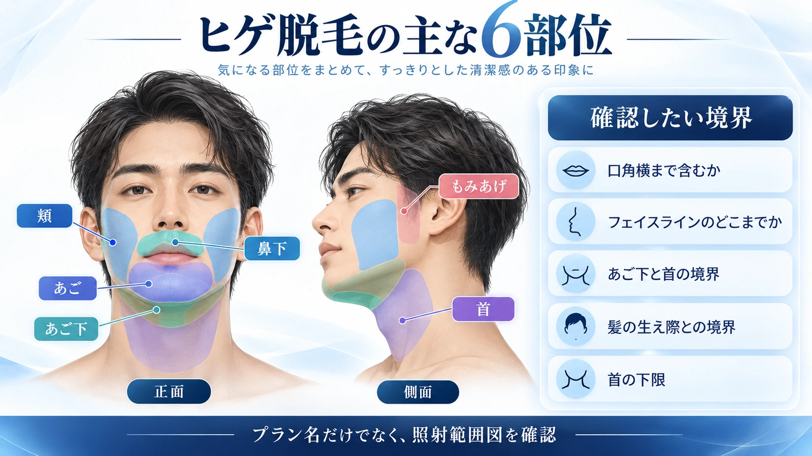 ヒゲ脱毛の鼻下・あご・あご下・頬・もみあげ・首の6部位を色分けした模式図