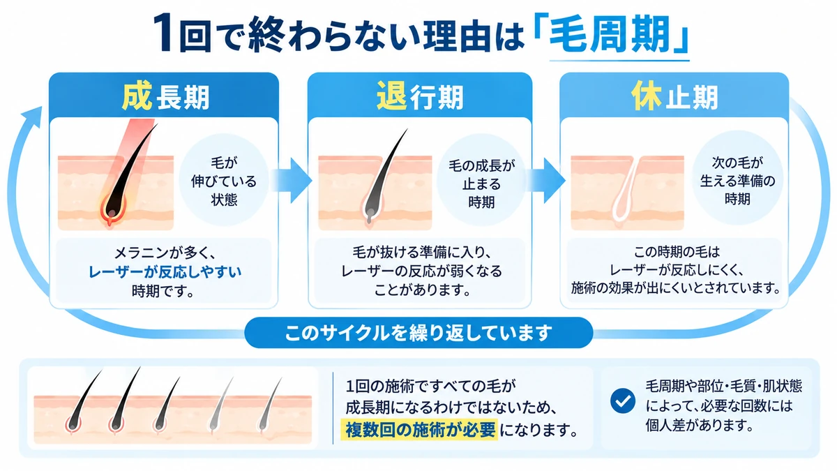 メンズ脱毛が1回で終わらない理由を毛周期で説明した図解