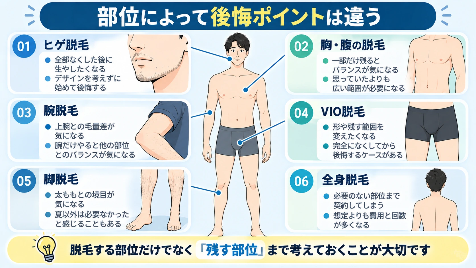 ヒゲやVIOなど部位別のメンズ脱毛で後悔しやすいポイントを示した図解