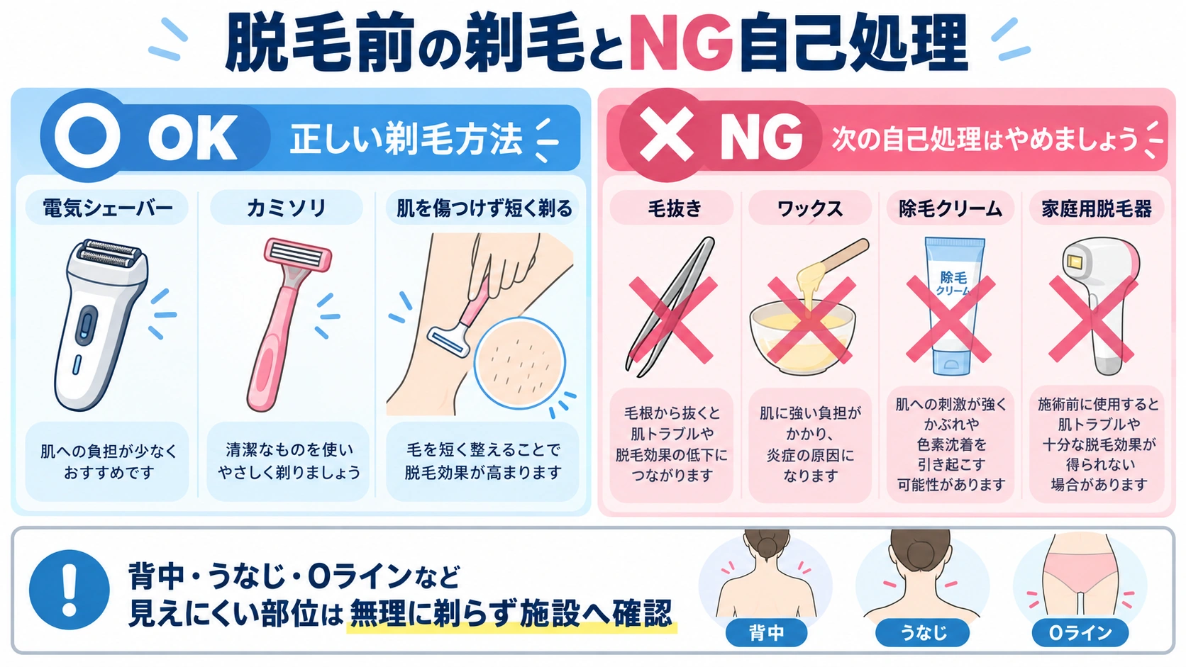 脱毛前の剃毛とNG自己処理 脱毛前の正しい剃毛方法と避けたい自己処理を比較した図