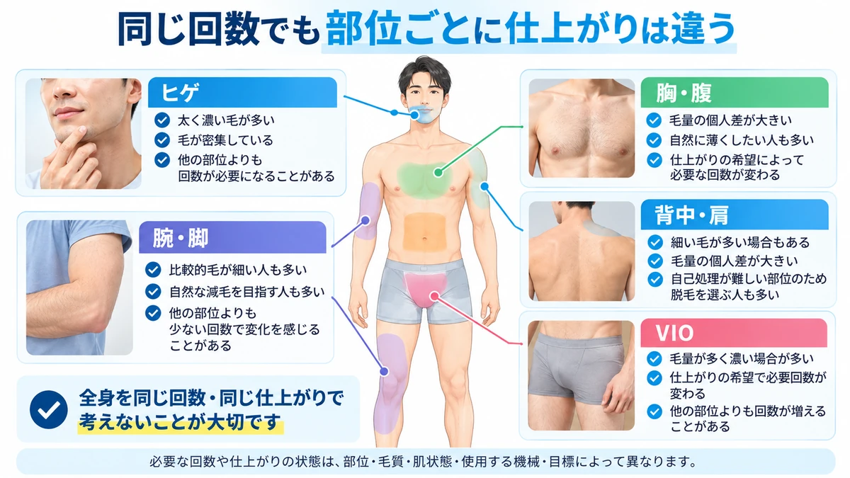 ヒゲやVIOなど部位ごとのメンズ脱毛の回数の考え方をまとめた図解